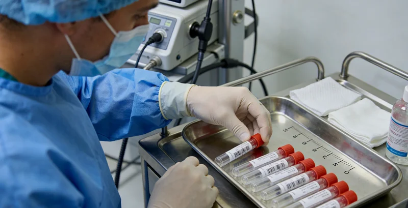 护士为患者进行静脉抽血用于液体