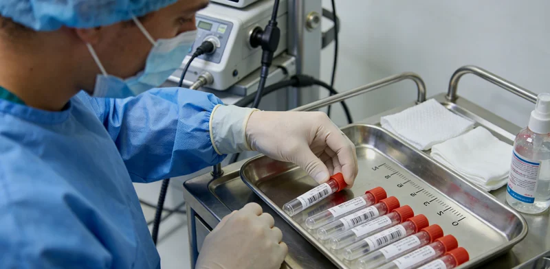 液体活检通过抽血检测循环肿瘤D