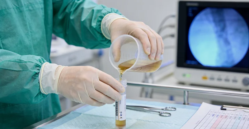 医生进行肺部穿刺活检获取检测样