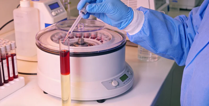 肺癌基因检测常用组织与血液样本