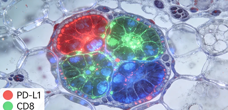 患者与肿瘤科医生讨论基因检测报